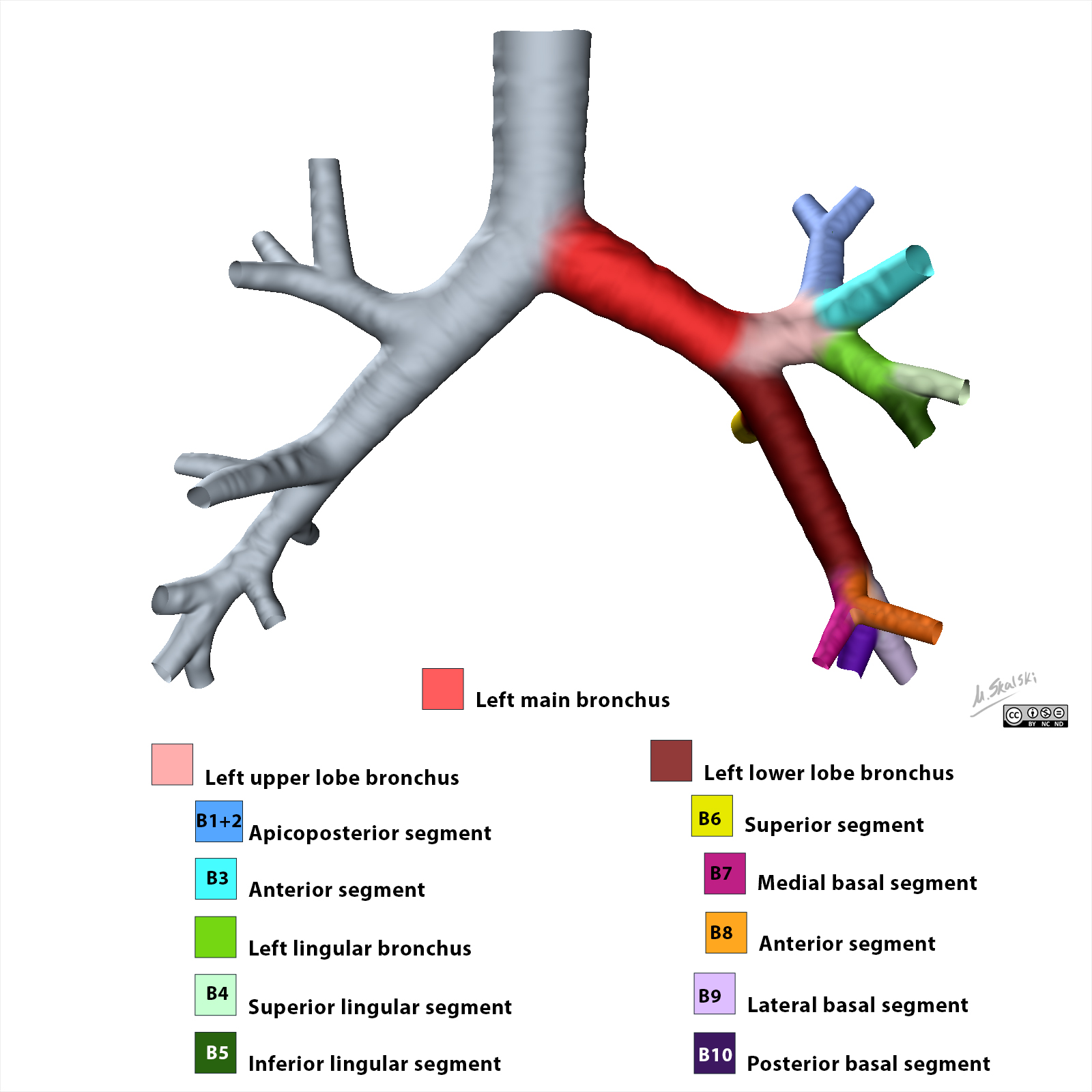 Radiopaedia Drawing Left Bronchial Tree From Anterior English